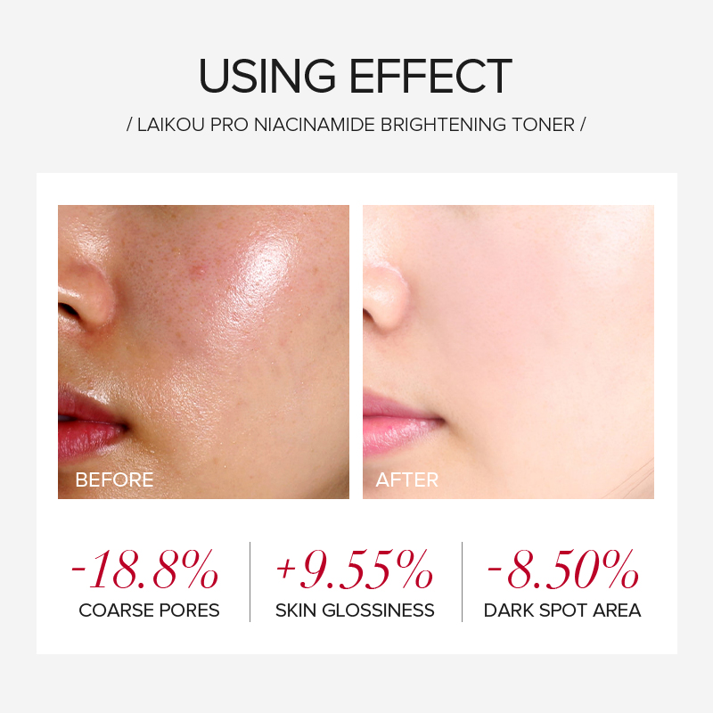 Conjunto de Cuidados com a Pel - Niacinamide Brightening Serum avaliação e preço