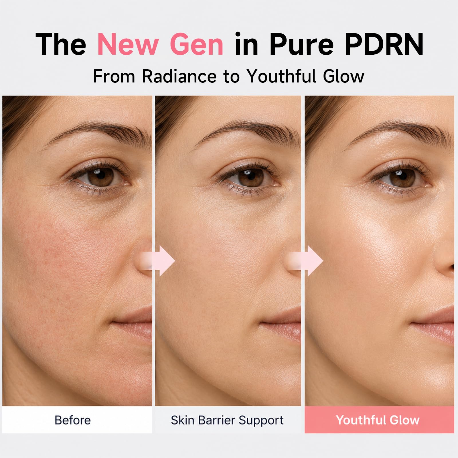 Sérum Facial PDRN Vitamina Ros - Niacinamide Brightening Serum avaliação e preço