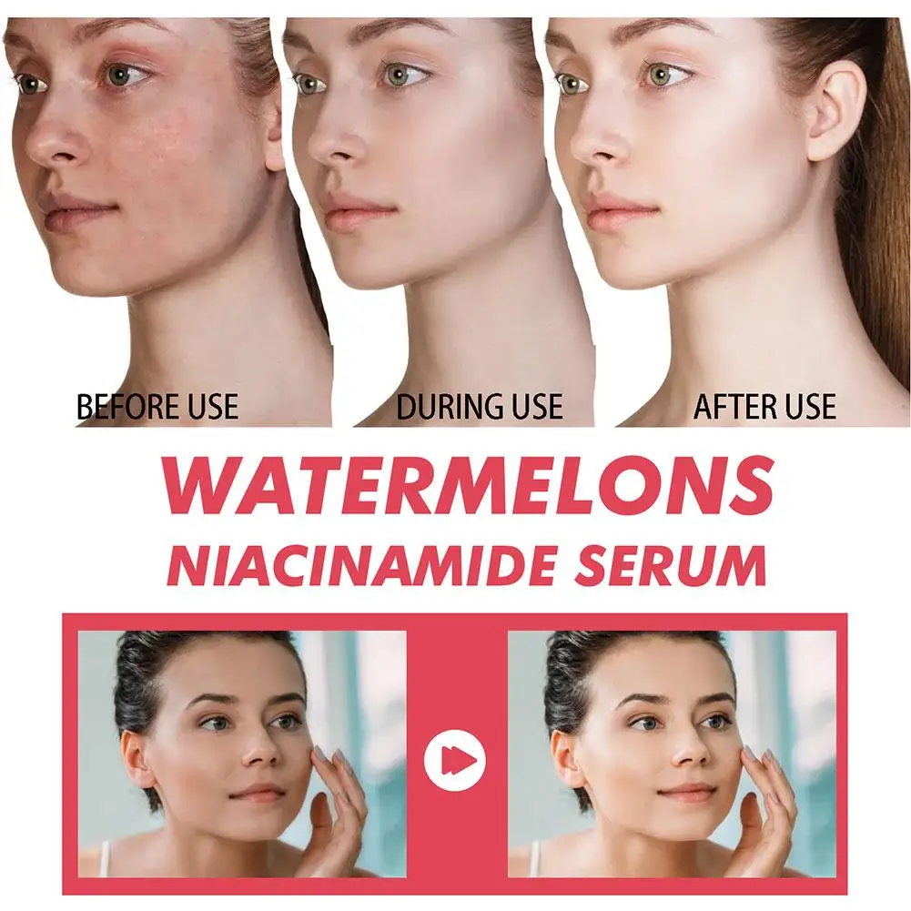 Soro hidratante de niacinamida - Niacinamide Brightening Serum avaliação e preço